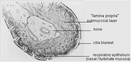 Fig 10: Mucosa Layers of right inferior turbinate cross section (under microscope).