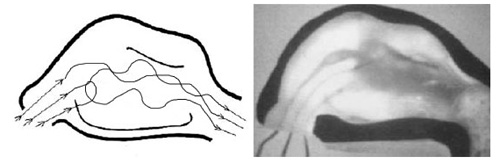 Fig 20: Flow pattern in Normal nose. 1=Ventral part of the inspiration stream, 2=Central part of the stream, 3=Dorsal part of the stream.