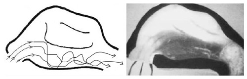 Fig 22: Flow pattern in nose after inferior turbinectomy.